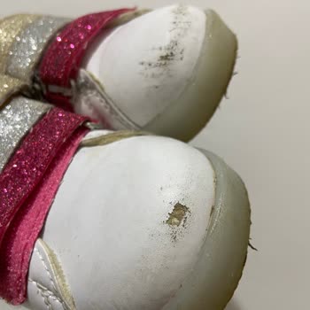 Vicco Ayakkabı Deri Soyulması Ve Çözüm Bulunmaması