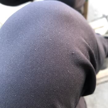 Notus Üniform Tüylenme Sorunu