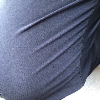 Notus Üniform Tüylenme Sorunu