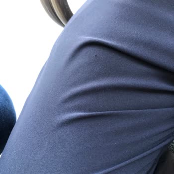 Notus Üniform Tüylenme Sorunu