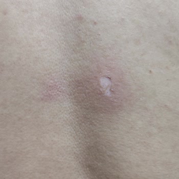 Medisana Masaj Aletindeki Kalite Sorunları Ve Müşteri Hizmetleri İlgisizliği