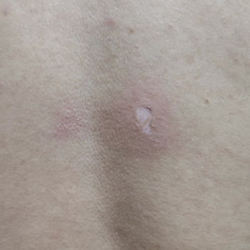 Medisana Masaj Aletindeki Kalite Sorunları Ve Müşteri Hizmetleri İlgisizliği