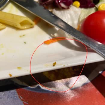 Tavuk Dünyası Yemeğimde Kurt Çıktı