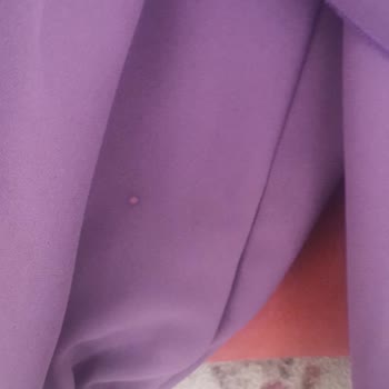 nursenaaydincom Hem Yanlış Ürün Hem De Defolu Ürün Göndermişler