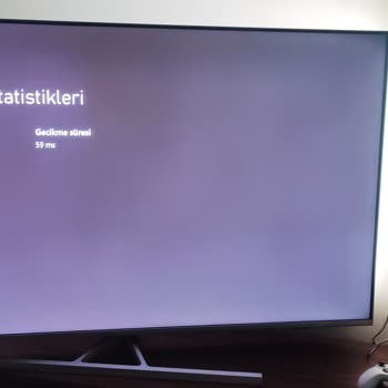 Kablo Net Xbox Paket Kaybı Sorunu