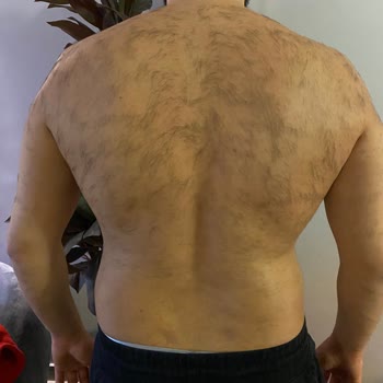 Venice Estetik & Güzellik Sorumsuz İşlem Sonucu