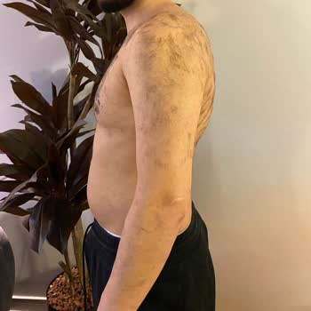 Venice Estetik & Güzellik Sorumsuz İşlem Sonucu