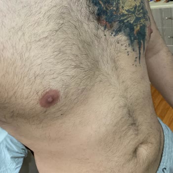 Venice Estetik & Güzellik Sorumsuz İşlem Sonucu