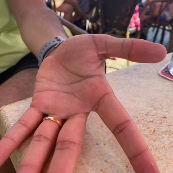 Starbucks SAW Şube Yüksek Asidik Dezenfektan Vakası Ve İlgilenmeyiş