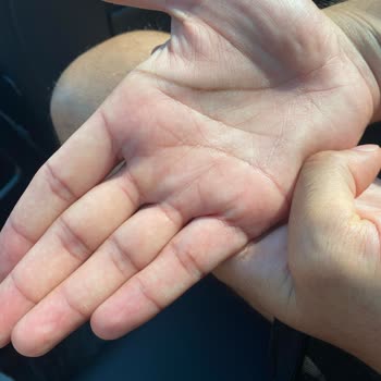 Starbucks SAW Şube Yüksek Asidik Dezenfektan Vakası Ve İlgilenmeyiş