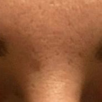 Clinicsam Estetik Güzellik Kaş Pudralama İşlemi