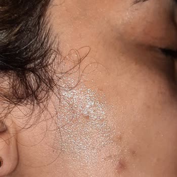 Garnier C Vitamini Aydınlatıcı Serum Ve Temizleme Jeli Sivilce Çıkardı