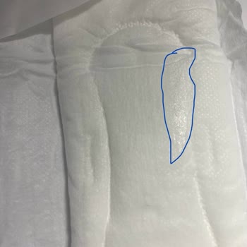 Sleepy Kadın Pedinin İç Tarafında Yapışkanlık Var.