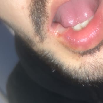 Kocaeli Üniversitesi Diş Hekimliği Fakültesi Diş İçin Gittim Dudağımı Kesmişler