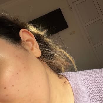 La Roche Posay Duo Akne Karşıtı
