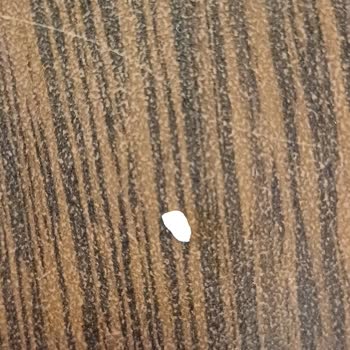 Burger King Hamburgerinden Taş Çıktı