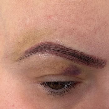 Özgür Kandemirli Beauty Kaş Silme İşleminde Yaşadığım Kötü Deneyim!