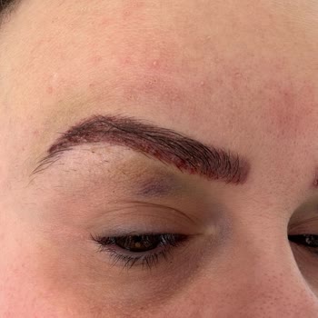 Özgür Kandemirli Beauty Kaş Silme İşleminde Yaşadığım Kötü Deneyim!