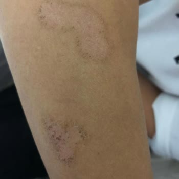 Nouvelle Vie Güzellik Merkezi Eskişehir Nouvelle Lazer