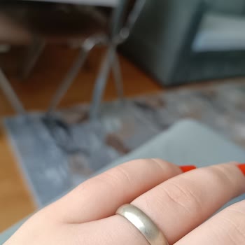 Atasay'dan Aldığımız Yüzüklerin Rengi Karardı Ve Mağduriyet Yaşıyoruz