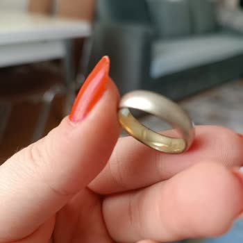 Atasay'dan Aldığımız Yüzüklerin Rengi Karardı Ve Mağduriyet Yaşıyoruz