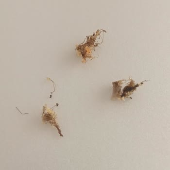 Hamsi Finger Midye Tavadan Kabuk Ve Kıl Çıktı