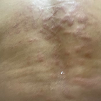 Sandra Güzellik Ve Epilasyon Salonu İle Yaşanan Sorunlar