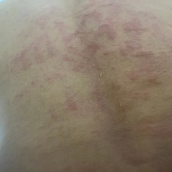 Sandra Güzellik Ve Epilasyon Salonu İle Yaşanan Sorunlar