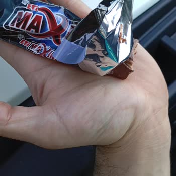 Eti Gıda Eti Maximus İçinde Yabancı Cisim