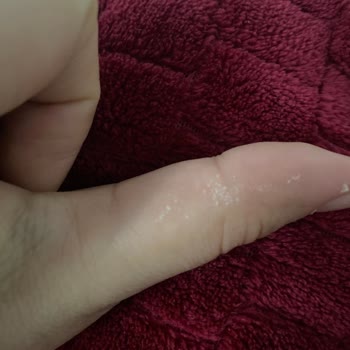 Palette Saç Açıcı Sprey Parmağımda Lekeler Bıraktı