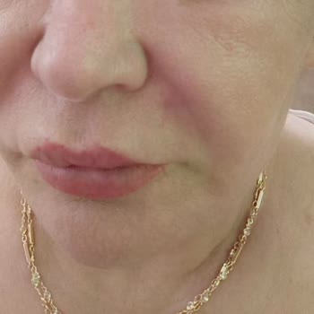 Boldeste Clinic Bizi Mağdur Etti!