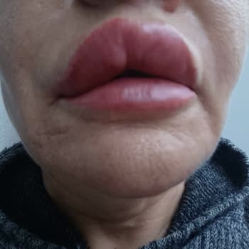 Boldeste Clinic Bizi Mağdur Etti!