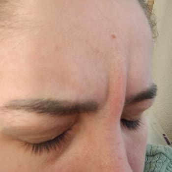 Boldeste Clinic Bizi Mağdur Etti!