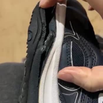 Sketchers Ayakkabılar İlk Ayda Parçalandı