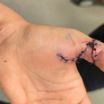 Kayseri Şehir Hastanesi Acil Doktorunun Bilgisizliği