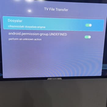 Onvo Cihazın Ayarlar Bölümü Detaylı Değil