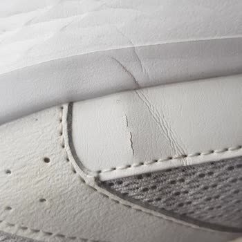 Torn & Deformed Skechers Shoes! Brand Claims User Error