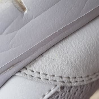 Torn & Deformed Skechers Shoes! Brand Claims User Error