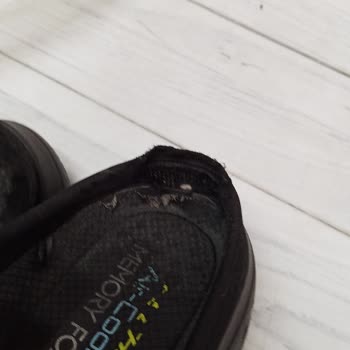 Skechers Terlik Yırtılması, Kullanıcı Hatası Olarak Görülmesi