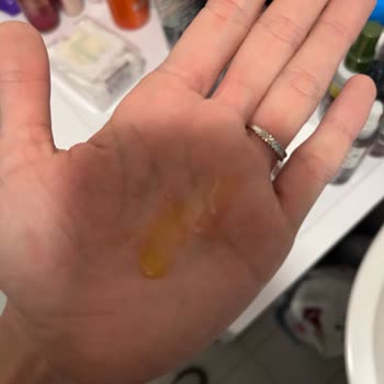 Watsonsın Ayıplı Purest C Vitamini Ürünü Ve Yardımcı Olmayışları