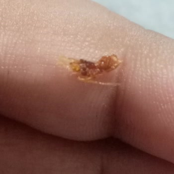 Lays Baharatlı Cips İçinden Tüylü Bir Şey Çıktı