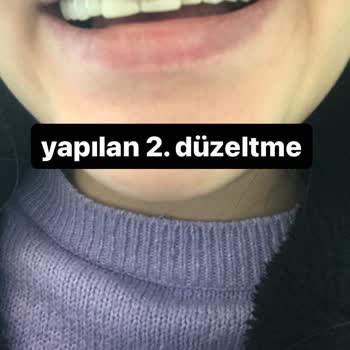 Tepebaşı Ağız ve Diş Sağlığı Eğitim ve Araştırma Hastanesi Şikayetçiyim Part 1