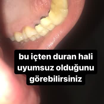 Tepebaşı Ağız ve Diş Sağlığı Eğitim ve Araştırma Hastanesi ŞİKAYETÇİYİM2 Hastane Yetkilileri