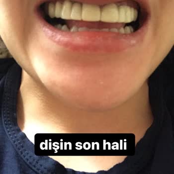 Tepebaşı Ağız ve Diş Sağlığı Eğitim ve Araştırma Hastanesi ŞİKAYETÇİYİM2 Hastane Yetkilileri