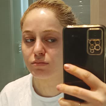 Sephora Yüzüm Alerji Oldu