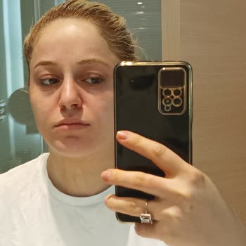Sephora Yüzüm Alerji Oldu