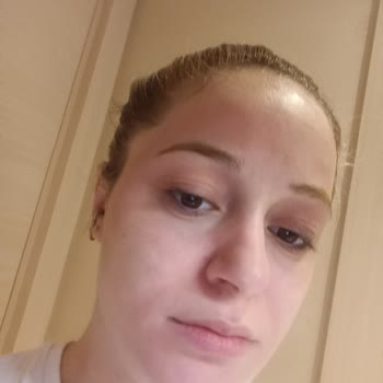 Sephora Yüzüm Alerji Oldu