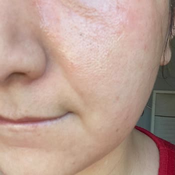 The Purest Solutions C Vitamin Serumu Yüzüme Zarar Verdi