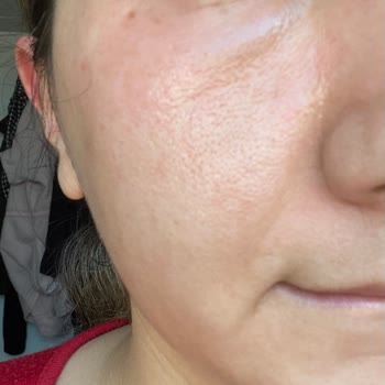 The Purest Solutions C Vitamin Serumu Yüzüme Zarar Verdi