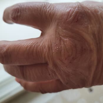 Balıkesir Büyükşehir Belediyesi Baskı Suyumuzu Düzelt